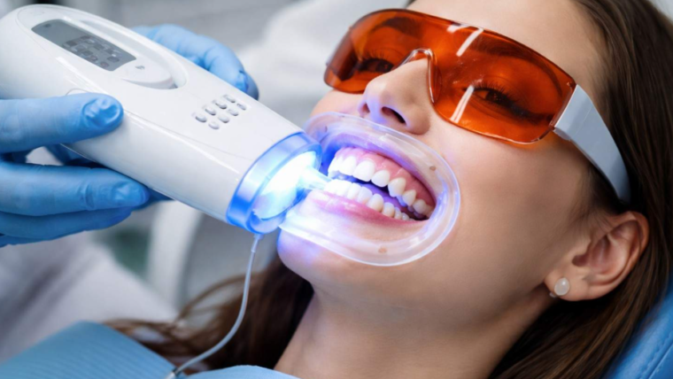 Professional teeth whitening in dental offices remains expensive, time-consuming and dependent on appointment availability. Yet the desire for a bright, white smile transcends budget constraints and scheduling flexibility. Professional-grade at-home whitening products bridge this gap, delivering results comparable to office treatments while offering convenience, cost-effectiveness and control over the whitening process. Modern whitening technology has democratized access to effective treatments previously available only through professional channels. Understanding how professional-grade products work, what ingredients matter and how to use them safely transforms teeth whitening from mysterious professional service into manageable personal care. Diamond Smile Teeth professional-grade options exemplify this accessibility, providing dentist-quality results at a fraction of traditional professional pricing.